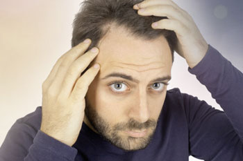 Calvitie: Perte des cheveux chez l'homme