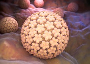 Le papillomavirus est l'une des IST les plus communes