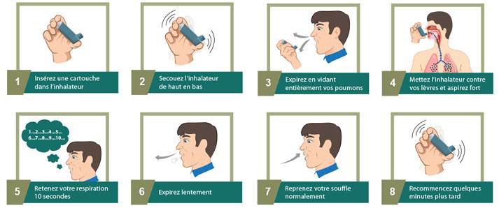 Mode d'emploi: Comment utiliser la Ventoline ?